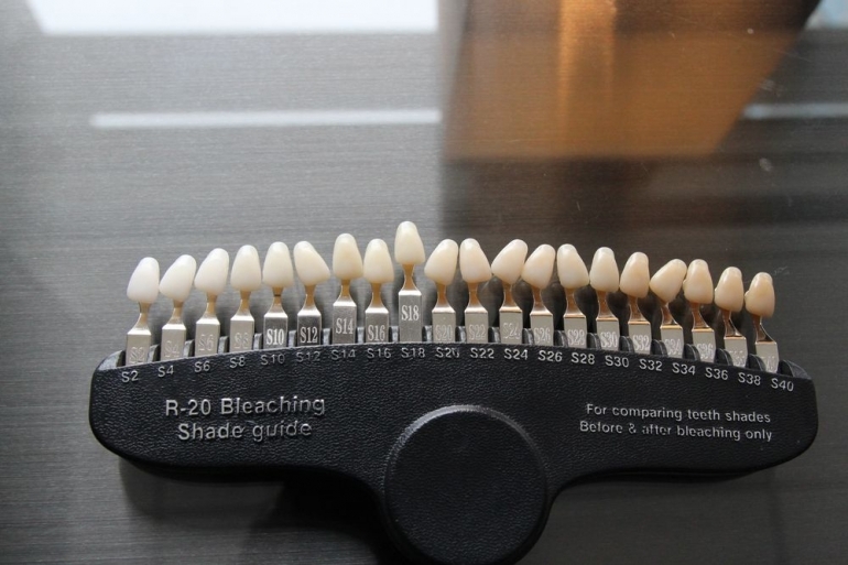 歯の標本