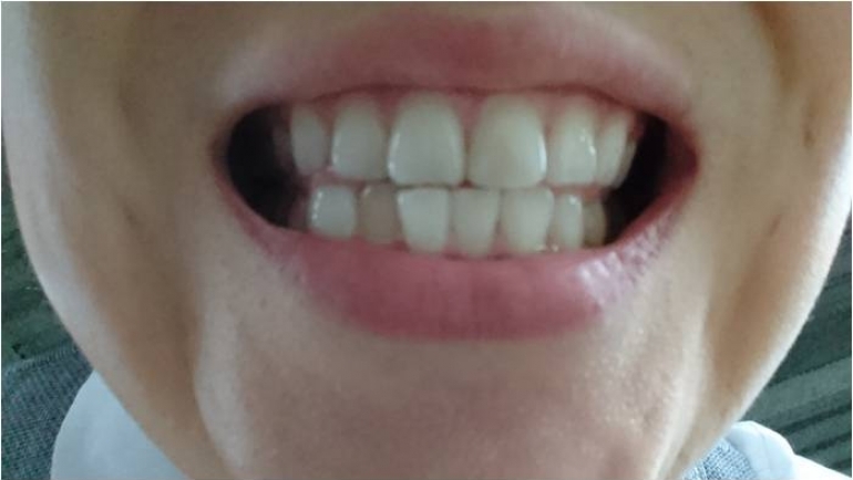 歯磨撫子 重曹つるつるハミガキ で ホワイトニング 歯磨きのwの役割 Hanone ハノネ 毎日キレイ 歯の本音メディア