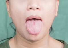 唇に白いブツブツができた際の適切な処置とは Hanone ハノネ 毎日キレイ 歯の本音メディア