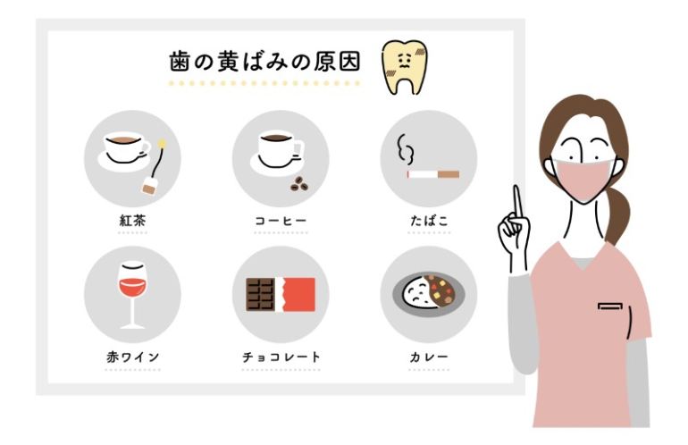 歯の黄ばみの原因